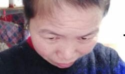 妻子爆料丈夫脱发视频大全,脱发危机何时了？