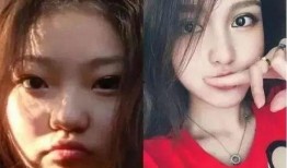 爆料整容视频,视频爆料引发热议